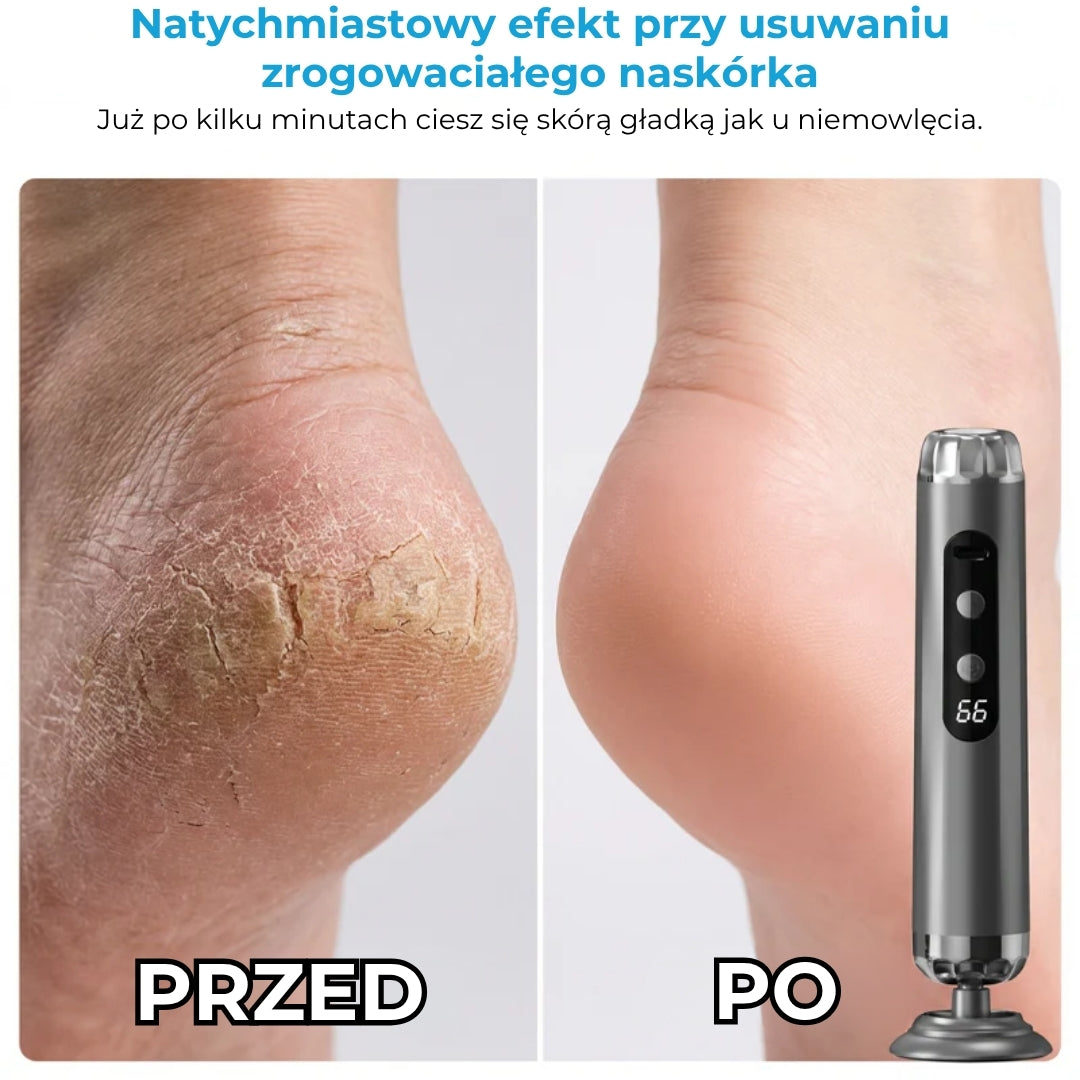 Elektryczny pilnik do stóp z 5 prędkościami